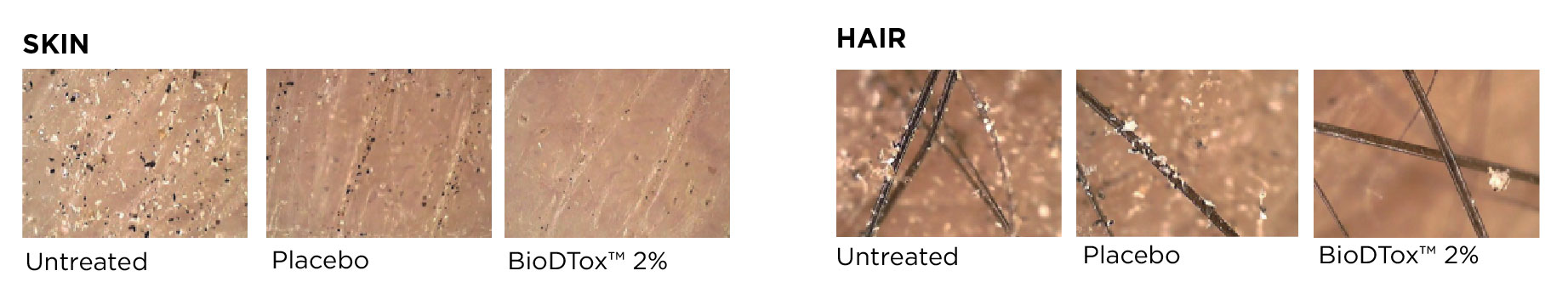 The images show a comparison of skin and hair conditions under three different treatments: Untreated, Placebo, and BioDTox™ 2%.

**Skin:**
- Untreated: The skin appears to have a significant amount of white flakes or particles.
- Placebo: The skin shows fewer white flakes compared to untreated but still has some visible particles.
- BioDTox™ 2%: The skin looks much clearer with minimal white flakes or particles.

**Hair:**
- Untreated: Hair strands have many white flakes or particles attached.
- Placebo: Hair strands still have white flakes, though slightly less than untreated.
- BioDTox™ 2%: Hair strands appear much cleaner with very few white flakes.

**Summary:**
BioDTox™ 2% treatment seems to significantly reduce the presence of white flakes or particles on both skin and hair compared to untreated and placebo treatments.