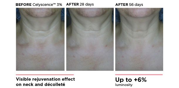 Before-and-after comparison of neck and décolleté skin showing visible rejuvenation over 56 days