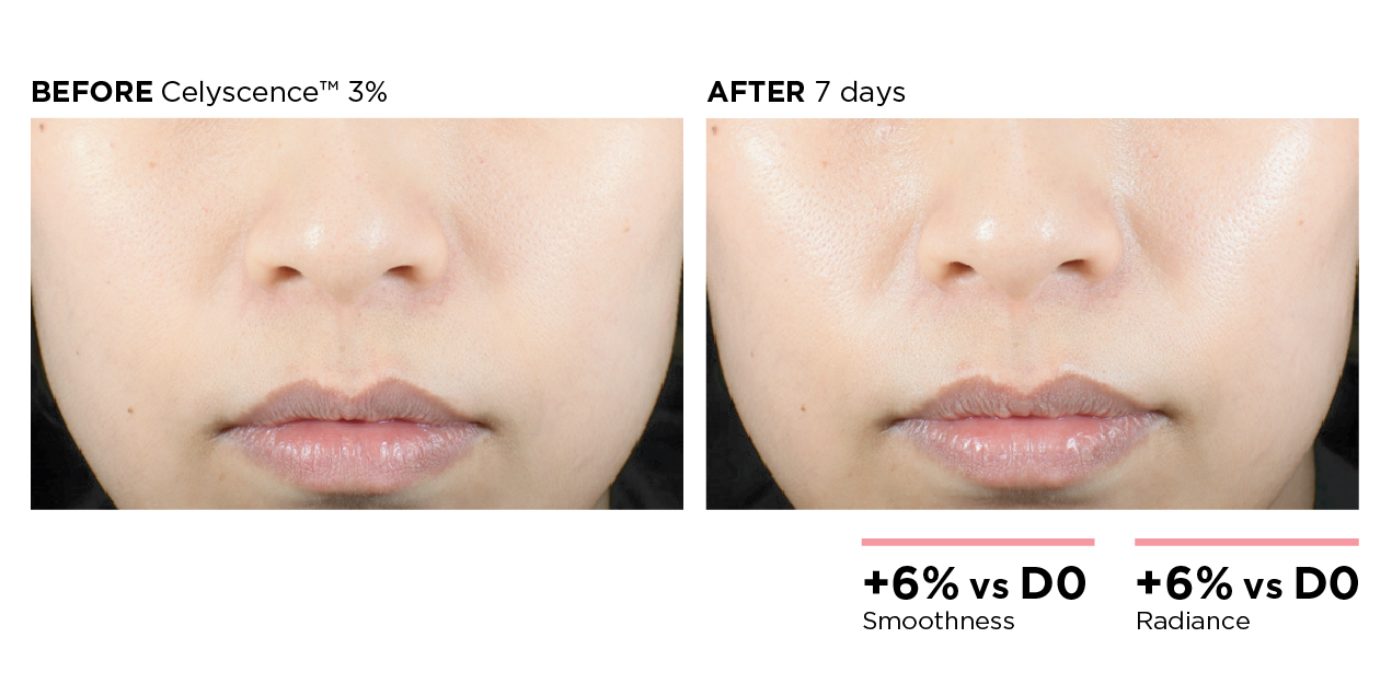 The image is a skincare before-and-after comparison.

- **Left:** “BEFORE Celyscence™ 3%”
- **Right:** “AFTER 7 days”

It shows a close-up of the lower half of a person’s face, with the after image appearing slightly smoother and more radiant. The text at the bottom claims:

- **+6% vs D0 Smoothness**
- **+6% vs D0 Radiance**

If you want, I can also help describe the visual differences more specifically or assess whether the comparison looks convincing.