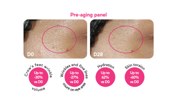 Comparison of skin texture before and after treatment, showing reduced wrinkles and improved hydration over 28 days.