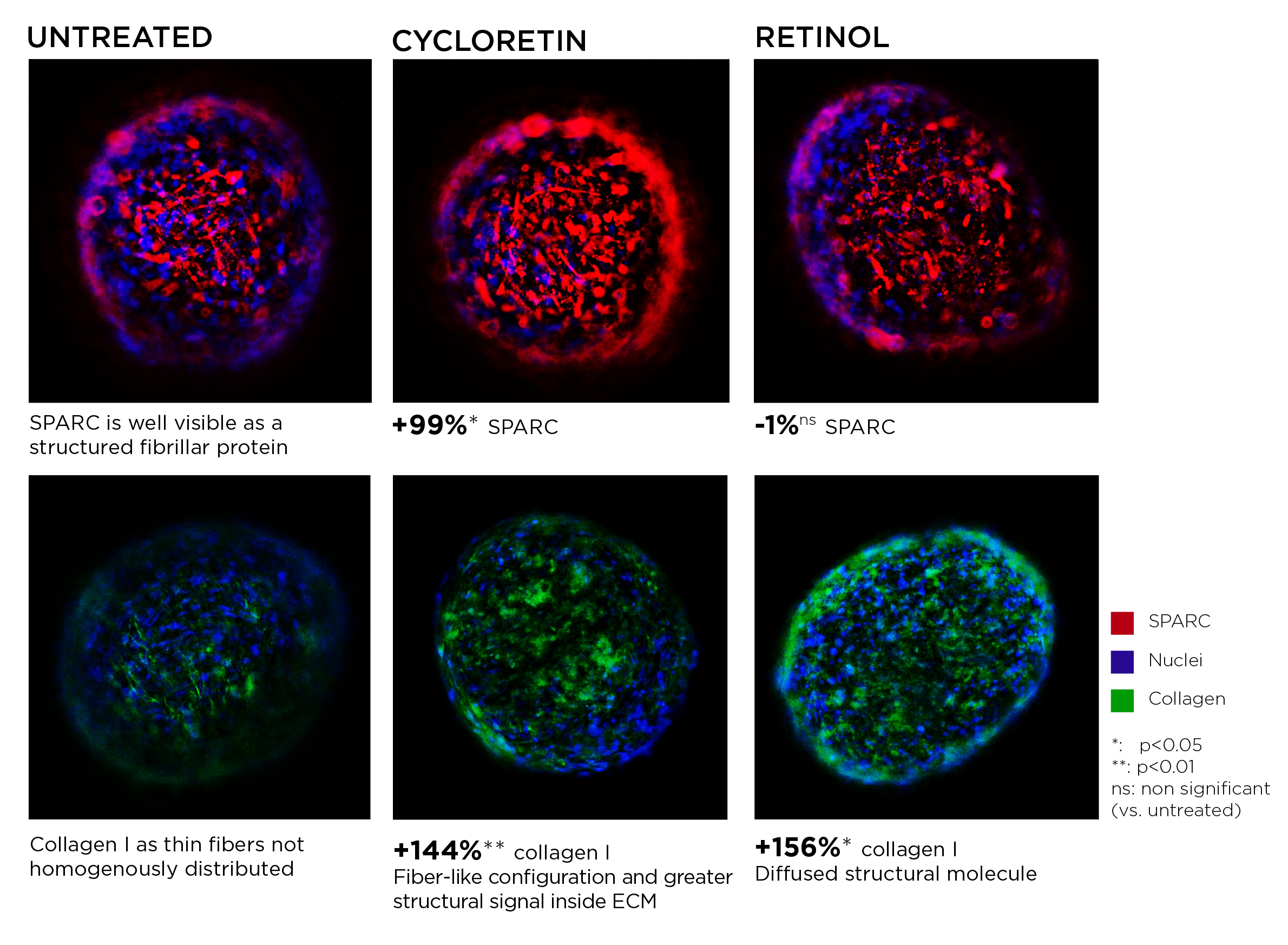 This image compares **untreated**, **cycloretin**, and **retinol** conditions in a 3D tissue/ECM model using fluorescence:

- **Red = SPARC**
- **Blue = nuclei**
- **Green = collagen**

### Main takeaways
- **Untreated:**  
  SPARC is visible as a **structured fibrillar protein**.  
  Collagen I appears as **thin, unevenly distributed fibers**.

- **Cycloretin:**  
  Shows a strong increase in **SPARC (+99%)** and **collagen I (+144%)**.  
  Collagen appears more **fiber-like** and more strongly organized inside the ECM.

- **Retinol:**  
  SPARC shows **no significant change (-1%, ns)**.  
  Collagen I increases even more **(+156%)**, but appears more **diffuse/structural** rather than strongly fiber-like.

### Overall interpretation
**Cycloretin** seems to enhance **SPARC** and promote a more **organized collagen fiber structure**, while **retinol** increases collagen I but does not significantly change SPARC and gives a more **diffuse collagen pattern**.