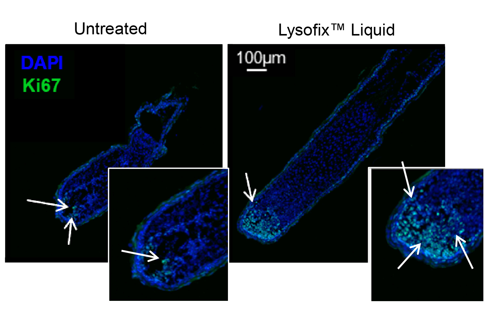 The image shows two panels comparing untreated and Lysofix™ Liquid treated samples stained with DAPI (blue) and Ki67 (green). 

- The untreated sample (left) shows very few green Ki67-positive cells, indicated by white arrows, suggesting low cell proliferation.
- The Lysofix™ Liquid treated sample (right) shows a significantly higher number of green Ki67-positive cells, also indicated by white arrows, suggesting increased cell proliferation.

The scale bar in the Lysofix™ Liquid panel indicates 100 µm for size reference. The insets provide a zoomed-in view of the respective samples, highlighting the difference in Ki67 expression more clearly. 

Overall, the treatment with Lysofix™ Liquid appears to enhance cell proliferation compared to the untreated condition.