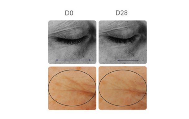 The image appears to show a comparison of skin condition over a period of 28 days, labeled as D0 (Day 0) and D28 (Day 28). The top row shows black and white images of the eye area, likely focusing on changes in wrinkles or fine lines. The bottom row shows close-up images of the skin, possibly highlighting changes in texture or pigmentation within a circled area. The purpose of these images is likely to demonstrate the effects of a skincare product or treatment over time, showing improvements or changes in the skin's appearance.