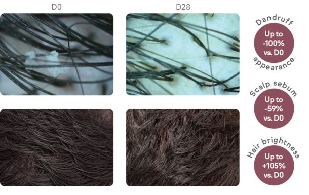 The image shows a comparison of scalp and hair conditions between Day 0 (D0) and Day 28 (D28). The top row displays close-up images of the scalp, while the bottom row shows the hair. 

On Day 0, the scalp has visible dandruff, and the hair appears less bright. By Day 28, the dandruff is significantly reduced or eliminated, and the hair looks brighter. The accompanying text highlights the improvements: dandruff appearance is reduced by up to 100%, scalp sebum is reduced by up to 59%, and hair brightness is increased by up to 105% compared to Day 0. This suggests a significant improvement in scalp and hair health over the 28-day period.