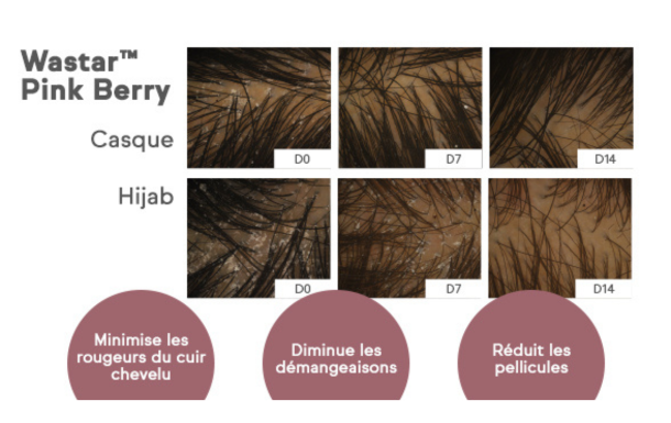 The image appears to be an advertisement or informational graphic for a product called "Wastar™ Pink Berry." It shows a series of close-up images of a scalp over a period of time (D0, D7, D14) for two different conditions: "Casque" (helmet) and "Hijab." The images seem to demonstrate the effects of the product on the scalp over time.

Below the images, there are three statements in French:
1. "Minimise les rougeurs du cuir chevelu" - Minimizes scalp redness.
2. "Diminue les démangeaisons" - Reduces itching.
3. "Réduit les pellicules" - Reduces dandruff.

These statements suggest that the product is designed to improve scalp health by reducing redness, itching, and dandruff, possibly for individuals who wear helmets or hijabs.